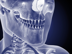 bone-grafting-4-excellence-in-dentistry