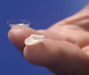 original_inline-veneer-contact-lens