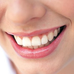 porcelain-cap-or-crown-4-excellence-in-dentistry