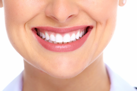 porcelain-veneers-4-excellence-in-dentistry