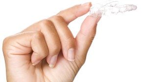 Clear-Correct-Aligner-300x168